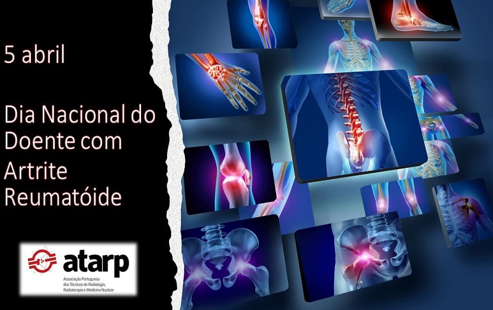 Dia Nacional do Doente com Artrite Reumatóide