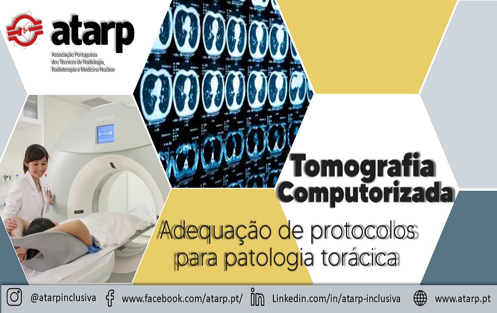 Curso Online Tomografia Computorizada - Adequação de protocolo para patologia torácica SESSÃO I